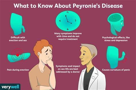 Peyronie disease